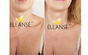 ell6